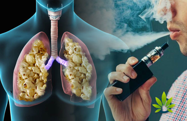 Is it True That Vaping Can Cause Popcorn Lung? Freeman Vape Is it True That Vaping Can Cause Popcorn Lung? Freeman Vape